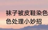 袜子被皮鞋染色怎么洗 袜子被鞋子染色处理小妙招