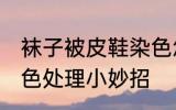 袜子被皮鞋染色怎么洗 袜子被鞋子染色处理小妙招